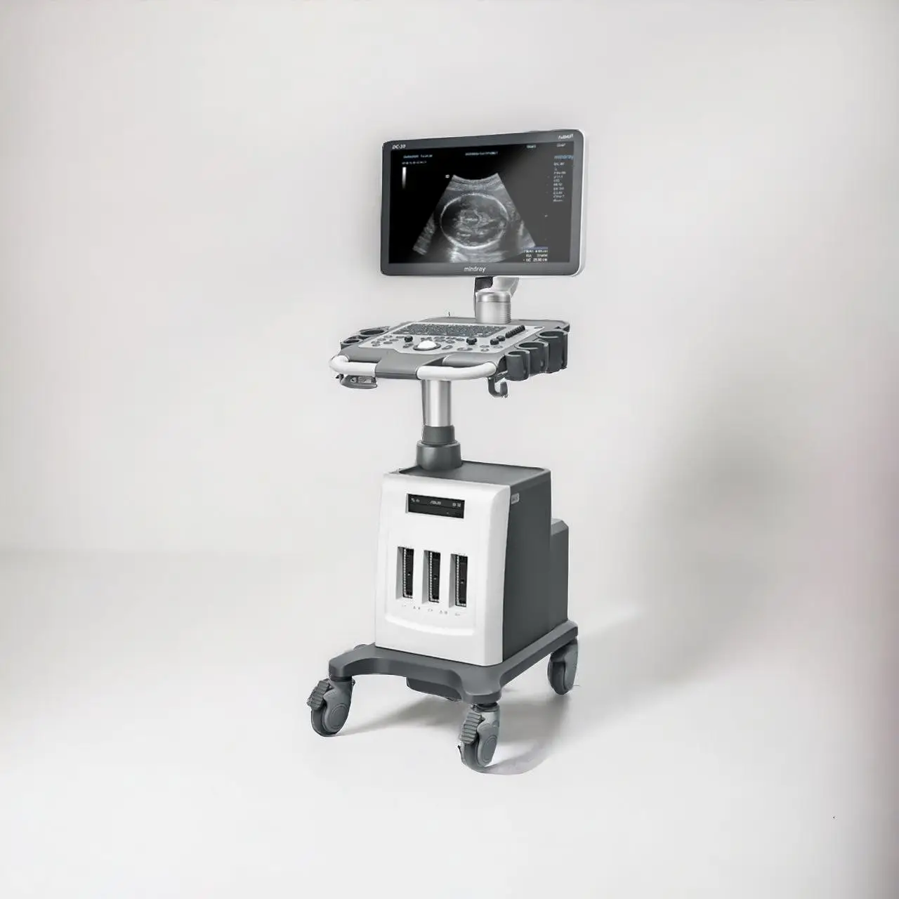 NEUES DIAGNOSTIKSYSTEM MINDRAY DC-30 FULL HD 2021